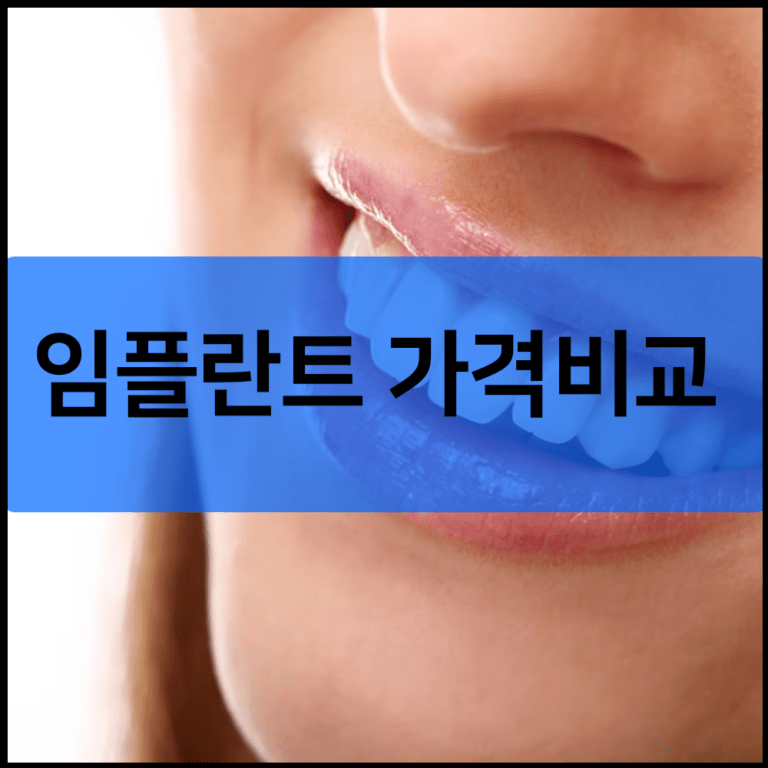 임플란트 가격비교